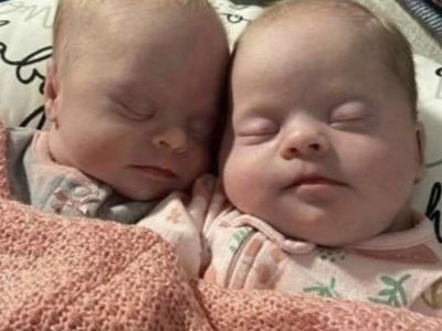 Mom of twins with Down syndrome shuts down critics