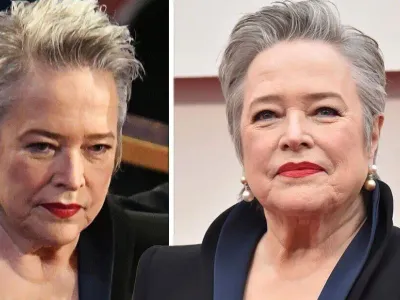 Kathy Bates: A Journey from Struggle to Stardom and Bravery Against Illness