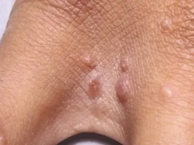 If You Have These Tiny Red Dots On Your Arm, Do Not Ignore The Warning Signs