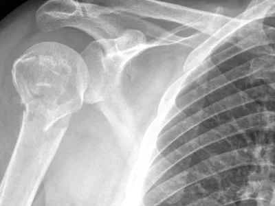 This Beverage Wrecks Your Bones, Yet You Sip It Daily! You Had No Idea!