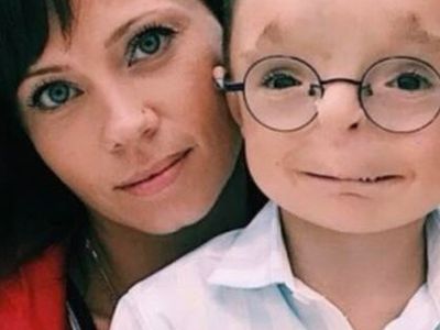 A kind-hearted woman adopted a child no one else wanted: See what they look like now.